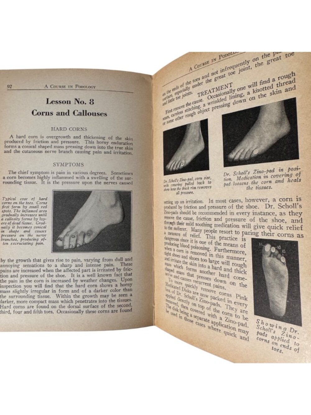 A Course in Podology National School of Podology Illust 1st Edition 1932 HC Book - Picture 11 of 16